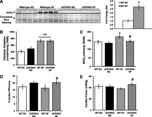 FIG. 1. UCP3 deletion does not alter cardiac FA oxidation but increases CE during HF feeding. A: Representative Western blot of cardiac UCP3 protein content and the corresponding densitometry normalized to Coomassie Blue staining in WT and UCP3 knockout mice fed NC or HF diet for 10 weeks. n = 4 per genotype and per feeding condition. B: Palmitate oxidation. C: MVO2. D: Percent CE. E: Cardiac power in the hearts of WT and UCP3 knockout mice fed NC or HF for 10 weeks. n = 6 per genotype for NC and n = 7–8 per genotype for HF. Data are means ± SEM. An unpaired, two-tailed Student t test was used to compare the groups in A. B–E: A two-way ANOVA was performed to analyze differences by diet and by genotype, including Bonferroni post hoc test, when significant interaction occurred. **P < 0.005 vs. diet (NC vs. HF); #P < 0.05 UCP3KOHF vs. WTHF. AU, arbitrary units; WHW, wet heart weight; DHW, dry heart weight. *P < 0.05 vs. diet (NC vs. HF).