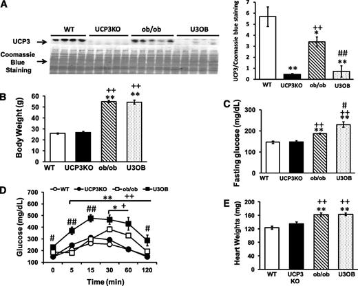 FIG. 3. Impact of UCP3 deletion in ob/ob mice on body weight, heart weight, and glucose homeostasis. A: Representative immunoblot and the corresponding densitometry of UCP3 protein normalized to Coomassie Blue staining. B: Body weights. C: Fasting blood glucose levels. D: Glucose tolerance tests. E: Heart weights of WT, UCP3KO, ob/ob, and U3OB mice at 20 weeks of age. n = 4–5 per group for Western blots. n = 8 for WT, n = 13 for UCP3KO, n = 6–9 for ob/ob, and n = 6–8 for U3OB for all other measurements. *P < 0.05; **P < 0.005 vs. WT; +P < 0.05; ++P < 0.005 vs. UCP3KO; #P < 0.05; ##P < 0.005 vs. ob/ob.