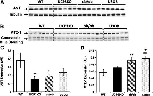 FIG. 6. Increased MTE-1 protein expression in ob/ob and U3OB hearts. A and B: Representative Western blots of ANT and the MTE-1 in whole-heart homogenates of WT, UCP3KO, ob/ob, and U3OB mice. C and D: Densitometry relative to tubulin and Coomassie Blue staining, respectively (n = 5 per genotype for ANT blot and n = 6 per genotype for MTE-1 blot). Data are means ± SEM. *P < 0.05; **P < 0.005 vs. WT; +P < 0.05 vs. UCP3KO. AU, arbitrary units.