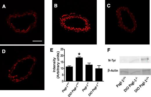 FIG. 2. Vascular superoxide detection by DHE fluorescence and nitrotyrosine by immunoblotting. Representative sections of confocal micrographs of sections of mesenteric arteries from control Psgl-1+/+ (A), DIO Psgl-1+/+ (B), control Psgl-1−/− (C), and DIO Psgl-1−/− mice (D). E: Pooled data of DHE fluorescence. F: Nitrotyrosine (N-Tyr) content in mesenteric arteries. Scale bar: 50 μm. n = 5 per group, *P < 0.05 compared with DIO Psgl-1−/− mice, control Psgl-1+/+, and control Psgl-1−/− mice. (A high-quality color representation of this figure is available in the online issue.)