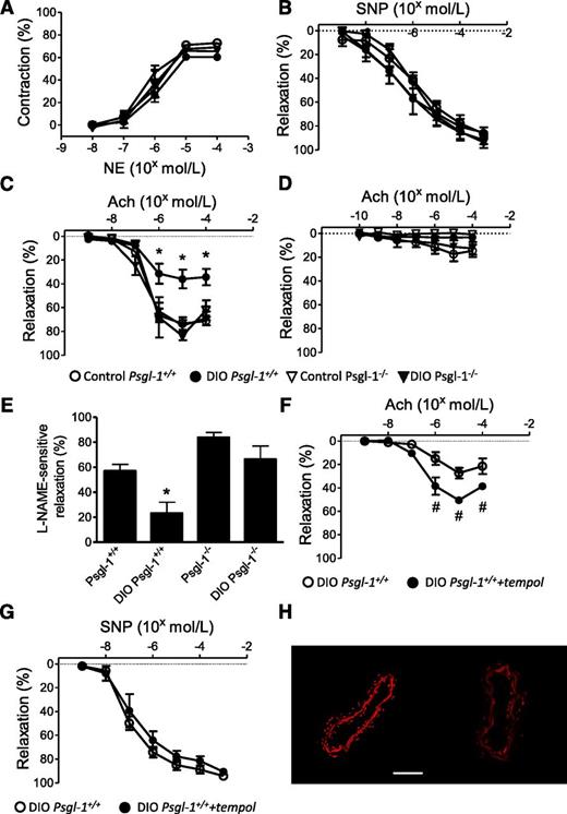FIG. 3. Vasoconstriction and vasorelaxation responses of mesenteric arteries (MA) and DHE fluorescence of MA after treatment with TEMPOL. Control, DIO Psgl-1+/+, and Psgl-1−/− mice (n = 5–7 per group). A: Concentration response to NE. B: Concentration response to SNP. C: Concentration response to Ach. D: Concentration response to Ach after preincubation in l-NAME. E: l-NAME–sensitive maximal vasorelaxation responses to Ach. F: Concentration response to Ach of MA from DIO Psgl-1+/+ after treatment with TEMPOL. G: Concentration response to SNP of MA from DIO Psgl-1+/+ after treatment with TEMPOL. H: DHE fluorescence of MA from DIO Psgl-1+/+ without (left) and with (right) TEMPOL treatment. Scale bar: 50 μm. *P < 0.05 compared with DIO Psgl-1−/− mice, control Psgl-1−/− mice, and control Psgl-1+/+ mice. #P < 0.05 compared with vessels without TEMPOL treatment. (A high-quality color representation of this figure is available in the online issue.)