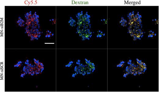 FIG. 1. Fluorescence microscopy of human islets after incubation with MN-siB2M or MN-siSCR probes for 48 h (red, Cy5.5; green, dextran; blue, DAPI nuclear stain). Colocalization of a Cy5.5 signal with anti-dextran staining provided direct evidence of the accumulation of both probes in islet cells (magnification bar = 50 μm). (A high-quality digital representation of this figure is available in the online issue.)