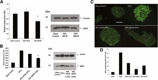 FIG. 2. Detection of downregulation of B2M expression by RT-PCR and Western blot. A: RT-PCR of human B2M mRNA expression in islets incubated with MN-siB2M or MN-siSCR probe for 48 h (*P < 0.05 compared with sham control) (left). Western blots showed decreased B2M protein levels in MN-siB2M–treated islets under basal conditions (right). B: RT-PCR of human B2M mRNA expression in islets treated with siRNA probes under IFN-γ–stimulated conditions (*P < 0.05 compared with IFN-γ treated islets) (left). Western blot showed a decreased level of B2M protein in MN-siB2M treated islets under IFN-γ stimulated conditions (right). C: Fluorescence microscopy confirmed that the B2M expression in MN-siB2M–treated islets was significantly decreased under IFN-γ–stimulated conditions compared with control and sham-treated islets (magnification bar = 50 μm). D: Immune reactivity of primed splenocytes against islet proteins obtained after islet incubation with MN-siRNA probes as assessed by ELISPOT (*P < 0.05 compared with sham-treated or MN-siSCR–treated islets). (A high-quality digital representation of this figure is available in the online issue.)