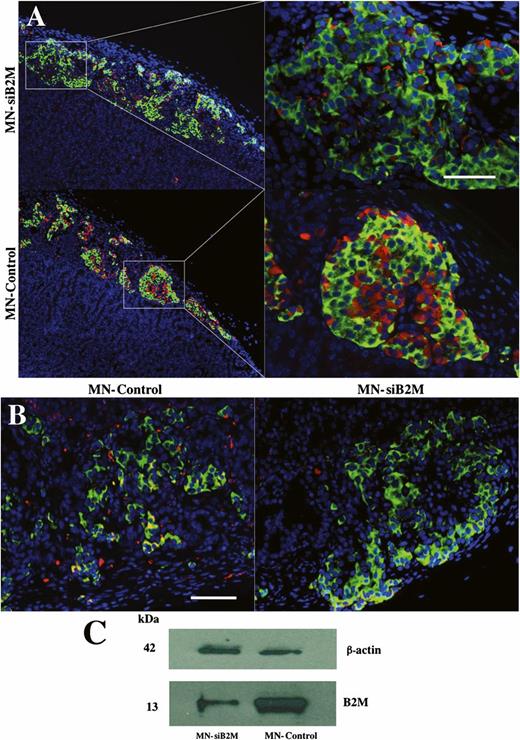 FIG. 5. A: Fluorescence microscopy revealed lower protein expression of B2M in MN-siB2M–treated grafts compared with control probe grafts 2 weeks after adoptive transfer (green, insulin; red, B2M; blue, DAPI nuclear stain; magnification bar = 50 μm). B: Fluorescence microscopy showed markedly lower CD8+ T-cell infiltration in MN-siB2M–treated grafts compared with control islet grafts 2 weeks after adoptive transfer (green, insulin; red, CD8; blue, DAPI nuclear stain; magnification bar = 40 μm). C: Western blot analysis confirmed notably lower B2M protein expression in MN-siB2M–treated islet grafts compared with control grafts. (A high-quality digital representation of this figure is available in the online issue.)