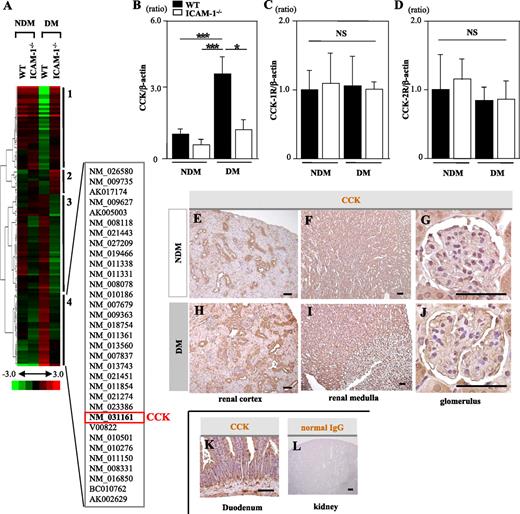 FIG. 1. The expression and distribution of CCK in kidney tissues of mice. A: Cluster analysis of differentially expressed genes comparing NDM WT and ICAM-1−/− mice and STZ-induced DM WT and ICAM-1−/− mice (n = 5/group). The dendrogram on the left of the cluster shows the relatedness of the change in gene expression. On the right of the cluster diagram, four groups of genes (1–4) are identified based on their gene expression changes. The list of constitutive genes involved in cluster 4 is given using the GenBank accession numbers. CCK was included in this cluster. B: CCK mRNA expression in the renal cortices was significantly increased in diabetic WT mice and significantly reduced to a nondiabetic level in diabetic ICAM-1−/− mice. C and D: The mRNA expressions of CCK-1R and CCK-2R were almost the same among the four groups. Values (means ± SEM) are presented as the ratio of nondiabetic WT. Data shown are representative of three separate experiments performed with five mice per group. E–G: Immunohistological staining of renal tissue specimens obtained from nondiabetic WT mice. The CCK-positive area was mainly observed in the distal tubules (E) and collecting ducts (F) and weakly in glomeruli (G). H–J: Immunohistological staining of kidney tissue specimens obtained from diabetic WT mice. The distal tubules (H) and glomeruli (J) were stained more intensely compared with those in the nondiabetic WT mice. A duodenal tissue specimen was used as a positive control (K). Normal IgG was also used as a negative control (L). Scale bars, 50 μm. *P < 0.05. ***P < 0.001. NS, P > 0.05. (A high-quality digital representation of this figure is available in the online issue.)