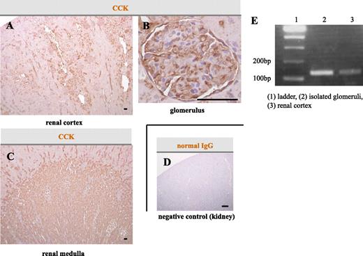 FIG. 3. Distribution of CCK in the rat renal tissues. A–D: Immunohistological staining of renal tissue specimens obtained from nondiabetic rats. The CCK-positive area was mainly observed in the distal tubules (A), glomeruli (B), and collecting ducts (C). Scale bars, 50 μm. Normal IgG was also used as a negative control (D). Scale bar, 500 μm. E: CCK mRNA expression was observed in isolated glomeruli and the renal cortex obtained from nondiabetic rats. (A high-quality digital representation of this figure is available in the online issue.)