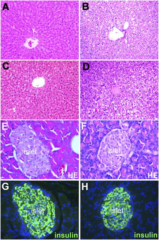 FIG. 2. Light microscopy of histopathological changes in liver and pancreatic islet. Liver specimens of male ZDF rats were obtained at the end of 2 months after stopping the 2-week treatment (A and B) and at the end of 1 year after stopping the 1-month treatment (C and D) with either JCU or vehicle. Tissue sections (4 μm) were stained with hematoxylin-eosin (HE). Light microscopic examination revealed normalized liver histological structure after JCU (A and C) but diffuse ballooning degeneration after vehicle (B and D). Pancreas specimens of male ZDF rats were obtained at the end of a 1-year observation period after discontinuing the 1-month treatment with either JCU or vehicle. The specimens were stained with HE (light microscopy) (E and F) or insulin (green; immunofluorescence microscopy) (G and H). The rats treated with JCU (E and G) or vehicle (F and H) exhibited similar pancreas cytoarchitecture (E and F) and insulin staining (G and H). Original magnification ×200. (A high-quality color representation of this figure is available in the online issue.)