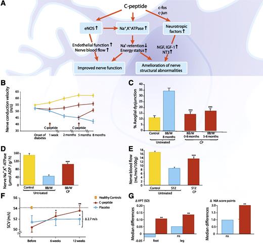FIG. 6. A: Schematic overview of functional and structural effects of C-peptide on diabetic neuropathy. B: C-peptide and NCV in diabetic BB/Wor rats. NCV in healthy (blue line) and diabetic BB/Wor rats given rat C-peptide in replacement dose (75 nmol C-peptide/kg/24 h) by subcutaneous pump infusion starting 1 week after onset of diabetes or after 5 months of diabetes (red lines, start of infusion indicated by arrows). The NCV declined progressively in the untreated diabetic animals (yellow line, P < 0.01 vs. controls) but increased in the C-peptide–infused animals (P < 0.05 vs. untreated BB/Wor rats). Data are from Ref. 60. C: C-peptide and the development of axoglial dysjunction in diabetic BB/Wor rats. Axoglial dysjunction was increased 3.5-fold in untreated diabetic rats (blue bar) compared with control rats (yellow bar). C-peptide (0–8 months and 5–8 months) prevented and reversed axoglial dysjunction (red bars; ***P < 0.001 vs. untreated diabetic rats). Data are from Ref. 60. D: C-peptide replacement results in a partial correction of the acute Na+,K+-ATPase defect in diabetic BB/Wor rats. Sciatic nerve Na+,K+-ATPase activity in healthy control rats (yellow bar), untreated BB/Wor diabetic rats (blue bar), and animals that received C-peptide for 2 months after diabetes onset (75 nmol/kg/24 h) shown. ***P < 0.001 vs. untreated diabetic rats. Data are from Ref. 60. E: C-peptide and nerve blood flow in diabetic rats. Endoneurial blood flow in STZ-induced diabetic rats was measured using a hydrogen elimination technique. Rats were treated for 2 weeks starting 6 weeks after onset of diabetes. Results are shown for healthy control rats (yellow bar), diabetic untreated rats (blue bar), and diabetic rats treated with C-peptide (red bar; 50 pmol/kg/min). ***P < 0.001 vs. untreated diabetic rats. Data are from Ref. 47. F: C-peptide and sensory nerve conduction velocity (SCV) in patients with type 1 diabetes and early stage neuropathy. Change in SCV after 6 (*P < 0.05) and 12 (**P < 0.001) weeks of C-peptide treatment (600 nmol/24 h, n = 26) or placebo administration (n = 20). The difference between the C-peptide and placebo groups at 12 weeks was statistically significant (2.1 m/s, *P < 0.05). Data are from Ref. 70. G: Effect of C-peptide on vibration perception (VPT) and clinical neurologic impairment (NIA score) after 6 months of C-peptide administration in type 1 diabetic neuropathy. Within the C-peptide groups (1.5 or 4.5 mg/day divided into four s.c. doses during 6 months, n = 92, red bars), both VPT and NIA score were significantly improved (**P < 0.01). The placebo group (n = 47, blue bars) showed no significant change in VPT or NIA. Data are from Ref. 71. BB/W, BB/Wor rats; CP, C-peptide; NT3, neurotrophin 3.