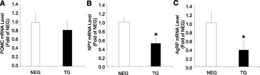 FIG. 2. Neuropeptide levels of liver FBPase transgenic (TG) mice. ARC neuropeptide mRNA levels in hemizygous TG mice (black bars) compared with negative (NEG, white bars) littermates measured by real-time PCR: POMC (A), NPY (B), and AgRP (C) (n = 4 for each group). *P < 0.03 vs. NEG, one-way ANOVA. All data expressed as mean ± SEM.