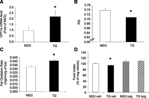 FIG. 6. Fat oxidation in liver FBPase transgenic (TG) mice. Liver CPT1-a mRNA levels (A), whole-body RQ (B), and whole-body fat oxidation rates (C) in TG and negative (NEG) littermate mice (n = 4). *P < 0.05 vs. NEG, one-way ANOVA. D: Food intake after FAO inhibition with etomoxir (10 mg/kg) treatment (n = 6). *P < 0.05 vs. all groups, one-way ANOVA. All data expressed as mean ± SEM.