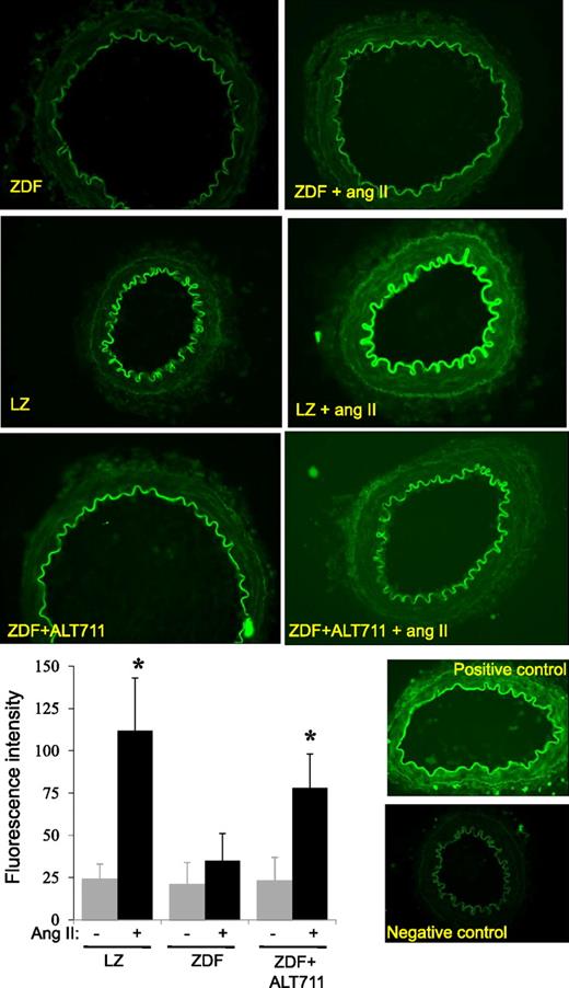 FIG. 7. Images showing in situ zymography obtained in arterial thin sections submitted to angiotensin II or not. Gelatinase activity was visualized as an enhanced fluorescence of a fluorogenic gelatin substrate in NF and HF arteries using confocal microscopy. Bar graph: Quantification of gelatinolytic activity was performed using image density analysis (three to four arterial sections per artery and six rats per group). Means ± SEM are presented. *P < 0.05, angiotensin II vs. control. (A high-quality color representation of this figure is available in the online issue.)