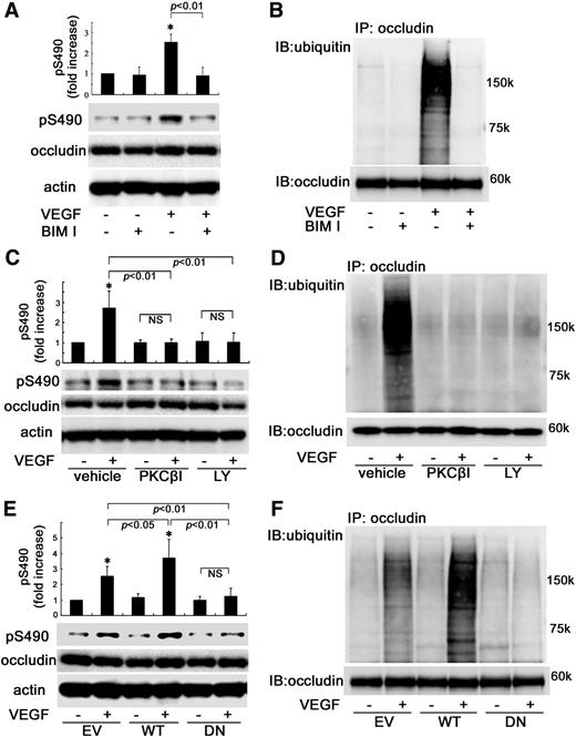 FIG. 1. The effects of PKCβ on occludin phosphorylation on Ser490 and ubiquitination in BREC (A–D). Pretreatment with BIM I, PKCβ inhibitor (PKCβI), or LY379196 (LY) suppressed VEGF-induced occludin phosphorylation of Ser490 and ubiquitination as determined by blotting with phospho-Ser490–specific antibody (A and C) or immunoprecipitation followed by ubiquitin blot (B and D). E and F: WT-PKCβ augmented and DN-PKCβ blocked these posttranslational modifications (n = 3–6); *P < 0.01 vs. control. IB, immunoblot; NS, not significant.