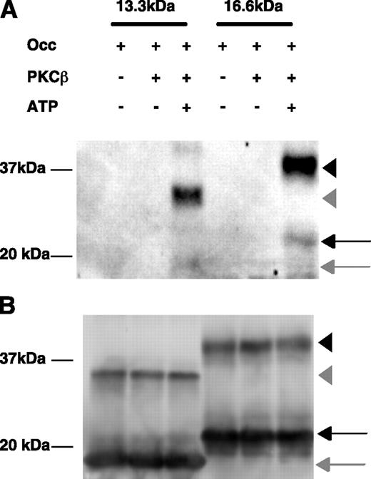 FIG. 3. PKCβII phosphorylates COOH-terminal fragments of occludin (Occ) in vitro. A: Both a 13.3-kDa (aa 413–522) and a 16.6-kDa (aa 383–522) fragment of the COOH-terminal fragment of occludin were phosphorylated by PKCβII only in the presence of ATP as observed using the occludin phospho-Ser490–specific antibody. Phosphorylation was observed on the monomer (arrow) but predominantly on the dimer (arrowhead) for the larger (black) and smaller (gray) occludin fragments. B: Occludin immunoblot with polyclonal occludin antibody.