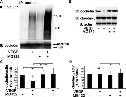 FIG. 7. Occludin ubiquitination and degradation in vivo. Coinjection of MG132 augments VEGF-induced occludin ubiquitination in vivo as observed by IP and ubiquitin blot, lower panel occludin monoclonal antibody blot (A). Treatment with MG132 prevented VEGF-induced occludin degradation in rat retinas, whereas claudin-5 content was unaffected (B–D) (n = 6–8); *P < 0.01 vs. control. IB, immunoblot; NS, not significant.