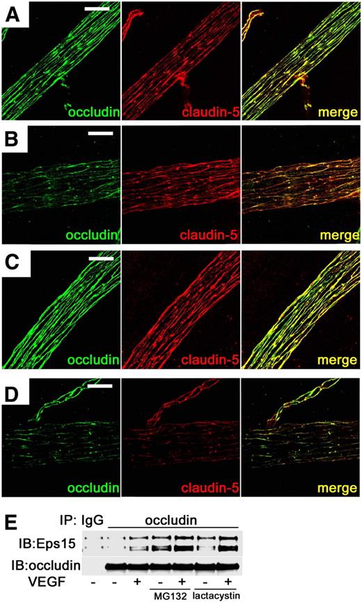 FIG. 9. MG132 augmented VEGF-induced TJ trafficking in rat retinal arterioles. VEGF induced TJ disruption at cell borders and increased intracellular staining of occludin and claudin-5 while simultaneous administration of VEGF and MG132 augmented this effect. (A) Controls, (B) VEGF injection, (C) MG132 injection, and (D) VEGF and MG132 injection. E: Coimmunoprecipitation in BREC showed that VEGF increased the interaction between Eps15 and occludin, and MG132 (or lactacystin) augmented this effect. Scale bar = 20 μm. IB, immunoblot. (A high-quality digital representation of this figure is available in the online issue.)