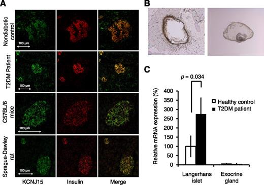 FIG. 1. Expression of KCNJ15 protein and mRNA in the islets of Langerhans. A: Immunofluorescence staining of the pancreas. KCNJ15 was stained with Alexa-488 fluorescence (green), and insulin was stained with Alexa-488 fluorescence (red). Images from the same sections were merged to form an overlapping image (yellow). B: Remaining section after the islet was cut and transferred by laser (left); single islet after it was cut by laser and transferred (right). C: KCNJ15 mRNA expression levels in the islets of Langerhans and exocrine glands. Values are mean ± SEM (n = 5; pooled samples of islets of Langerhans). T2DM, type 2 diabetes mellitus. (A high-quality digital representation of this figure is available in the online issue.)
