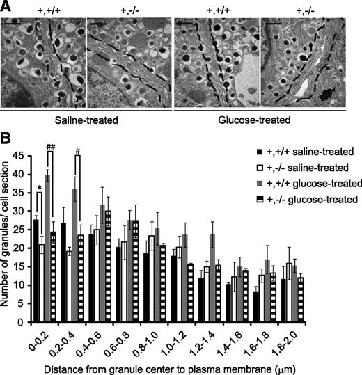 FIG. 7. Impaired insulin granule trafficking in FAK-deficient β-cells leads to a lower number of docked insulin granules. A: Electron micrographs of β-cell sections. Scale bar, 500 nm. Black dashed lines indicate a distance of 200 nm from the plasma membrane, showing that β-cells of RIPcre+fakfl/fl mice have a fewer number of insulin granules docked at the plasma membrane in both saline-treated or glucose-treated (15 mmol/L) conditions. B: Quantification of relative granule distribution and density in the first 2-μm region adjacent to the plasma membrane; n = ∼2,000 insulin granules from 12–15 β-cells were counted from three mice per genotype. *Comparison between saline-treated RIPcre+fak+/+ and RIPcre+fakfl/fl islets. #Comparison between glucose-treated RIPcre+fak+/+ and RIPcre+fakfl/fl islets. *,#P < 0.05; ##P < 0.01. Results represent mean ± SE. All mice used in experiments were between 4 and 8 weeks of age. +,+/+, RIPcre+fak+/+; +,−/−, RIPcre+fakfl/fl.