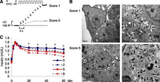 FIG. 3. Effects of the genetic risk score. A: Depolarization-evoked exocytosis in β-cells from donors with different scores. B: Electron micrographs of human islet sections from an individual with low (top) and high (bottom) score. Docked insulin granules (arrows), lipid droplets (*), nuclei (N), lipofusic bodies (LB), and plasma membrane (PM) are indicated. Left scale bars, 2 μm; right, 0.5 μm. C: Effects of the risk score on insulin secretion during IVGTT in 604 individuals. Data are means ± SEM. *P < 0.05.