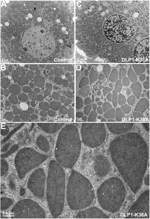 FIG. 2. Ultrastructural images of hepatocyte mitochondria. A and B: Electron photomicrographs of control hepatocytes show circles and ovals for mitochondrial sections. C–E: Electron photomicrographs show mitochondria in DLP1-K38A–expressing cells. C and D: Irregular shapes of mitochondria are prevalent along with thin tubules. E: A higher magnification image shows mitochondria with narrow constrictions and connections.
