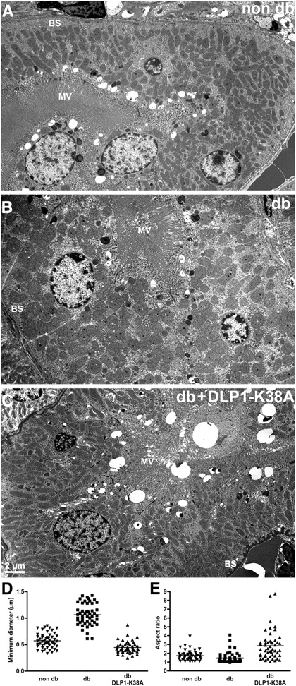 FIG. 7. Electron photomicrographs of kidney proximal tubules show mitochondria in nondiabetic (non-db) mice are elongated (A), whereas those in STZ-induced diabetic (db) kidney are round and appear to be swollen (B). C: Mitochondria in diabetic mice expressing DLP1-K38A (db + DLP1-K38A) are elongated, similar to those in non-db kidney. MV, microvilli; BS, basal stripes. D: Measurement of the minimal axis of the kidney mitochondria indicated a swollen phenotype. The mean value of the minimal diameter of the mitochondria in diabetic animal (STZ) was much higher than in the control, demonstrating the swollen mitochondrial morphology. Mitochondria from hyperglycemic dTg[rtTA/K38A] mice had a smaller minimal axis than the diabetic or control mice. The mean values of the minimal axis length of dTg[rtTA/K38A] mitochondria were decreased by 58% (P = 5.3 × 10−15) compared with those of diabetic mitochondria (n = 50). E: A calculation of the AR showed the roundness of mitochondrial shape in diabetic kidney proximal tubules. Mitochondria from hyperglycemic dTg[rtTA/K38A] mice had the larger AR value than the diabetic or control mice, representing their elongated shape. The mean values of the AR of dTg[rtTA/K38A] mitochondria were increased by 50% compared with those of control mitochondria (n = 50).