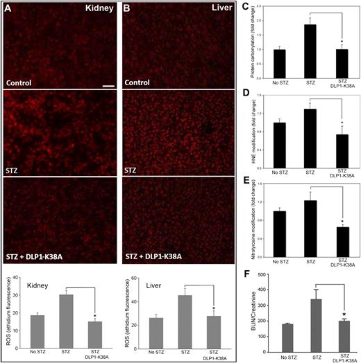 FIG. 8. DLP1-K38A expression in mice relieves the diabetic oxidative stress. A and B: ROS evaluation in kidney and liver. Ethidium fluorescence shows increased ROS levels in STZ-treated diabetic kidney (A) and liver (B), and the lower levels of ROS in Dox-fed dTg[rtTA/K38A]. Scale bar: 50 μm. Error bars are SEM (n = 5, 10, and 7 for no STZ, STZ, and STZ/DLP1-K38A, respectively). P < 0.05. C–E: Assessments of oxidative stress in diabetic conditions. STZ-induced hyperglycemia increases protein carbonylation (C), 4-hydroxynonenal (4-HNE) (D), and nitrotyrosine (E) modifications in kidney. Dox-fed dTg[rtTA/K38A] diabetic mice show reduced levels of protein carbonylation (n = 8 for each group; *P < 0.01), 4-HNE (n = 4, 6, and 4 for no STZ, STZ, and STZ+DLP1-K38A, respectively; *P < 0.05), and nitrotyrosine (n = 4, 6, and 4 for no STZ, STZ, and STZ+DLP1-K38A, respectively; *P < 0.05) modifications. F: The serum BUN-to-creatinine ratio was increased in STZ-injected control mice but remained low in Dox-fed dTg[rtTA/K38A] mice (n = 12, 8, and 9 for no STZ, STZ, and STZ+DLP1-K38A, respectively). *P < 0.05. Error bars are SEM. (A high-quality digital representation of this figure is available in the online issue.)