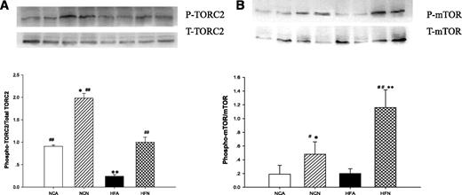 FIG. 6. Effect of ICV nesfatin-1 on liver TORC2 and mTOR (T-mTOR:Total-mTOR and P-mTOR:phospho-mTOR activation. Four treatment groups were studied: NCA, NCN, HFA, and HFN. Central nesfatin-1 administration markedly increased liver TORC2 (A) and mTOR (B) phosphorylation in both SD- and HFD-fed rats. Ratio of phosphorylated vs. total AMPK and Akt was calculated and is shown as means ± SE (n = 5). *P < 0.05, **P < 0.01 vs. ICV ACF-infused rats (NCA), #P < 0.05, ##P < 0.01 vs. HFD-fed rats (HFA).