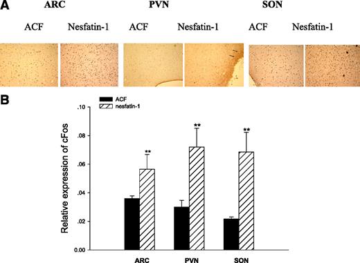 FIG. 7. Central nesfatin-1 stimulates Fos immunoreactivity (ir) in hypothalamic regions. A: Photomicrographs of coronal brain sections showing Fos immunostaining in the arcuate (ARC), paraventricular (PVN), and supraoptic nucleus (SON), after ICV nesfatin-1 or ACF treatment. Arrows illustrate that the number of Fos-positive cells was significantly greater. B: Number of Fos-ir cells per section in hypothalamic regions. Data are mean Fos-ir cells/hemisphere ± SEM; n = 4. **P < 0.001 vs. ACF. (A high-quality digital representation of this figure is available in the online issue.)