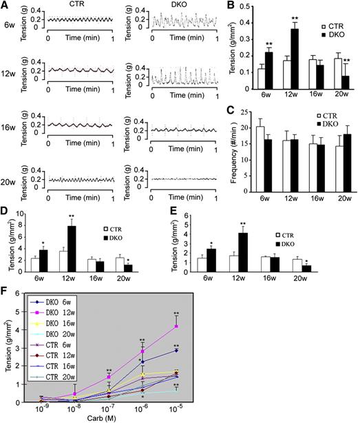 FIG. 1. DKO mice exhibit increased spontaneous and stimulated bladder contractions early in life and decreased contractions later in life. A: Representative spontaneous contractions of bladder strips in floxed control (CTR) and liver-specific Irs1/Irs2 DKO mice. Quantification of the amplitude (B) and frequency (C) of spontaneous contraction. D: Bladder smooth muscle contraction induced by KCl (120 mmol/L) stimulation in DKO and CTR mice. Bladder smooth muscle contraction induced by carbachol (Carb) stimulation at 10−5 mol/L (E) and 10−9 to ∼10−5 mol/L (F). The tension data were obtained from eight strips from four animals in each group and normalized by the length, width, and weight of muscle strips. Bladder tissue was stretched to a passive tension of 0.5 g and allowed to equilibrate for 45 to ∼60 min before experiments were performed. Isometric force was continuously recorded with a computerized data acquisition program at a sampling rate of 20 Hz. CTR indicates the littermate combined floxed Irs1 and Irs2 gene control animal. Data are representative of at least three different experiments and are expressed as the means ± SEM, by unpaired Student t test. *P < 0.05 and **P < 0.01 compared with age-matched control group. w, weeks.
