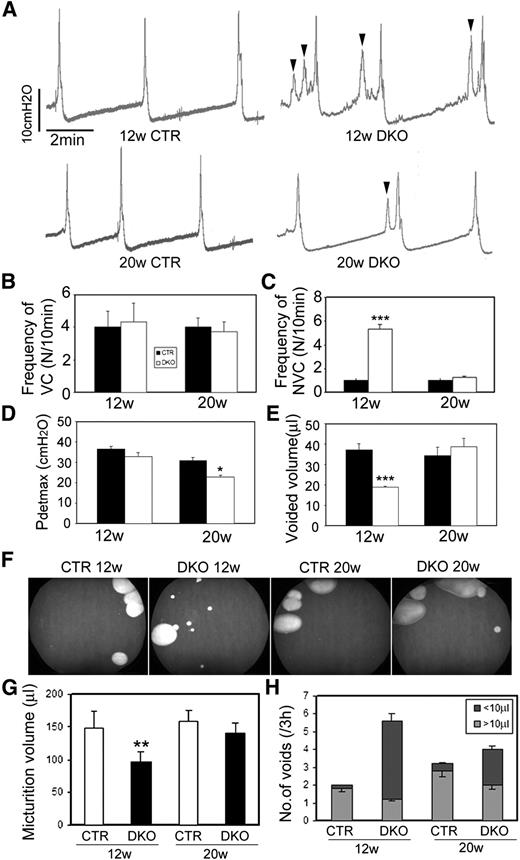 FIG. 2. DKO animals exhibit abnormal voiding pattern. A: Original cystometric recordings in control (CTR) and DKO mice at the age of 12 and 20 weeks (w). Arrowheads reflect abnormal bladder contractions not associated with urination. Evaluation of urodynamic parameters: frequency of voiding contractions (VC) (B), frequency of nonvoiding contractions (NVC) (C), amplitude of the detrusor contraction during voiding (Pdetmax) (D), and voided volumes (E) (n = 6 for DKO; n = 5 for CTR). F: Representative spontaneous micturition pattern of unrestrained animals. G: Micturition volume. H: The frequency of smaller volume voids (<10 μL). The slope of the calibration curve (cm2)/volume (μL) was 0.14 (1 cm2 of area corresponds to 7.14 μL volume; n = 6 mice for each group). Data are representative of at least three different experiments and are expressed as the means ± SEM, by unpaired Student t test. *P < 0.05, **P < 0.01, and ***P < 0.001 compared with age-matched control group.