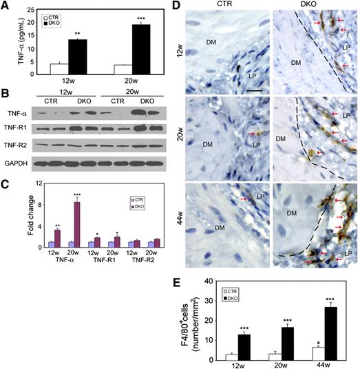 FIG. 3. Increased inflammatory mediators in DKO mice. A: Serum soluble TNF-α level. B: Representative immunoblot of three different experiments of TNF-α and TNFR1 protein levels. C: Quantification of immunoblot protein expression by normalization to glyceraldehyde-3-phosphate dehydrogenase (GAPDH). D: Representative immunostaining for macrophages (arrows pointed). DM, detrusor muscle; LP, lamina propria; w, weeks. Original magnification ×400. Scale bar: 20 μm. E: Quantification of F4/80+ macrophages in bladder tissue. The results in bar graphs are presented as mean ± SEM, n = 5, by unpaired Student t test (A and C) or 1-way ANOVA (E). *P < 0.05, **P < 0.01, and ***P < 0.001 compared with age-matched control group; #P < 0.05 compared with 12-week-old control. (A high-quality digital representation of this figure is available in the online issue.)