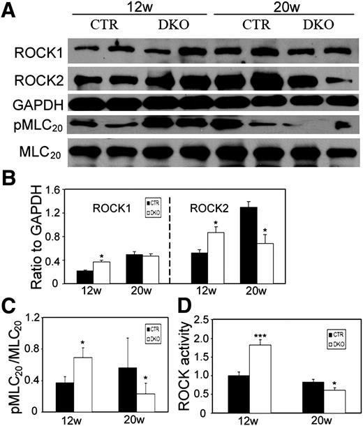 FIG. 4. Expression of ROCK and MLC20 proteins and activity of Rho kinase is associated with contractility in DKO bladders. A: Representative immunoblot analysis in bladder smooth muscle extracts. Glyceraldehyde-3-phosphate dehydrogenase (GAPDH) was used as a loading control. B and C: Densitometric analyses of immunoblot. The level of ROCK1 and ROCK2 was normalized to GAPDH, and the level of pMLC20 was expressed as a percentage of total MLC20 protein levels. D: ROCK activity of bladder smooth muscle homogenates, which was expressed as optical density (OD) and normalized to control (CTR) group. Data were from three independent experiments and presented as mean ± SEM, by Student t test. *P < 0.05 and ***P < 0.001 compared with age-matched control group. w, weeks.