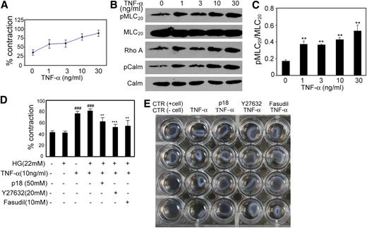 FIG. 5. TNF-α promotes BSMC contraction. A: TNF-α promoted contraction of BSMC in a dose-dependent manner. B: Representative of three independent immunoblots of BSMCs stimulated with 1–30 ng/mL TNF-α. C: Quantification of MLC20 phosphorylation. D: The effect of high glucose (HG, 22 mmol/L d-glucose, Invitrogen), MLCK inhibitor peptide 18 (p18, Tocris Bioscience), ROCK inhibitor Y27632 (Enzo Life Sciences), and Fasudil (Tocris Bioscience) on TNF-α–induced cell contraction. E: Representative cell contraction image of three independent experiments. The cell contraction was detected after 2.5 h treatment with 10 ng/mL TNF-α, pretreated with inhibitors for 30 min or pretreated with HG for 24 h. CTR, untreated control; Calm: total calmodulin; pCalm, phospho calmodulin. Cell contraction was determined in triplicate or quadruplicate and expressed as the percentage of contraction, which was quantitated as the percentage of lattice size diminution relative to the area of the well. Data are representative of three different experiments and are expressed as the means ± SEM, by Student t test (C) or one-way ANOVA (D). ###P < 0.001 compared with untreated group; **P < 0.01 and ***P < 0.001 compared with TNF-α–treated group. (A high-quality color representation of this figure is available in the online issue.)
