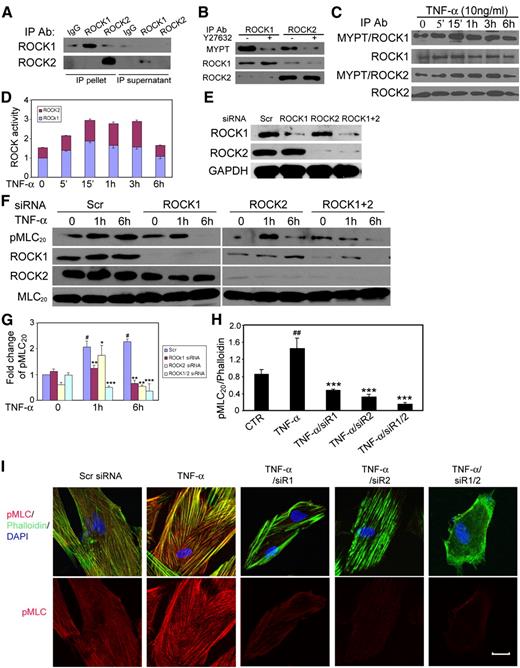 FIG. 6. ROCK1 and ROCK2 regulate TNF-α–induced MLC20 phosphorylation. A: Isoform-specific ROCK immunoprecipitation. B: Kinase activity assay. C: Determination of ROCK activation in BSMCs after TNF-α stimulation. D: Quantification of ROCK activity: The ROCK1 activity in untreated control cells was defined as 1, and the relative amount of ROCK1 and ROCK2 activity was presented. E–G: Augmentation of ROCK1 or ROCK2 by TNF-α expression was inhibited by suppression of ROCK1 or ROCK2 using siRNA. BSMCs were transfected with scrambled (Scr) or ROCK1/ROCK2-targeted siRNA for 48 h, followed by TNF-α stimulation for 1 or 6 h, and protein expression of ROCK1 or ROCK2 (E), or the level of pMLC20/MLC20 (F) was examined by immunoblot and quantified (G). H: Quantification of pMLC20 expression in immunostained BSMCs. The phosphorylation of MLC20 was quantified and normalized as the ratio of pMLC20 relative to phalloidin. Data are expressed as mean ± SEM by two-way ANOVA (G) or one-way ANOVA (H). #P < 0.05 and ##P < 0.01 compared with scrambled group at 0 h; *P < 0.05, **P < 0.01, and ***P < 0.001 compared with TNF-α–treated scrambled group, respectively. I: Representative immunofluorescence microscopy of BSMCs of three different experiments. Scale bar: 20 μm. (A high-quality digital representation of this figure is available in the online issue.)