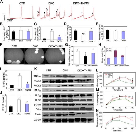 FIG. 7. TNFRI treatment reversed bladder dysfunction of 12-week-old DKO mice. Six-week-old animals were intraperitoneally injected with soluble TNFR1 (TNFRI, 2 mg/kg, PEG-TNFRI, Amgen), twice per week, or saline solution for controls. Blood GTT was performed before the treatment and after 3- and 6-week treatment. After 6 weeks of treatment, half of the animals were evaluated by VSOP analysis and cystometry. Remaining mice were killed and bladders were retrieved for protein extraction. A: Representative cystometry recordings. Arrowheads represent abnormal nonvoiding bladder contractions. B: Frequency of voiding contractions (VC). C: Frequency of nonvoiding contractions (NVC). D: Volume of voids. E: Detrusor pressure during voiding contractions (Pdetmax). F: Representative micturition patterns of single freely moving mice. Administration of TNFRI increased micturition volume (G) and decreased the frequency of small volume voids (<10 μL) (H). I: The level of TNF-α in serum. J: ROCK activity in bladder smooth muscle homogenates. K: Representative immunoblot analysis. Calm, calmodulin; GAPDH, glyceraldehyde-3-phosphate dehydrogenase. GTT value before treatment (L) and at 3 weeks (M), and 6 weeks after treatment (N). Data (n = 6 mice for each group) are representative of three different experiments and are expressed as the means ± SEM, by one-way ANOVA. *P < 0.05, **P < 0.01, and ***P < 0.001 compared with floxed control (CTR) group. #P < 0.05 and ##P < 0.01 compared with DKO nontreated control group.