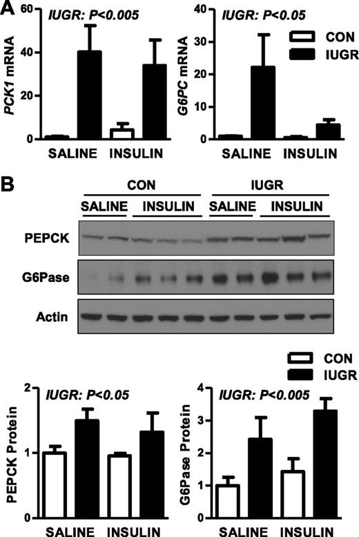 FIG. 3. The effect of growth restriction (IUGR) and hyperinsulinemia (insulin) on the expression of gluconeogenic genes and proteins in the fetal liver. Liver samples were collected from CON and IUGR fetuses after a saline infusion (saline) or hyperinsulinemic clamp (insulin). A: RNA was analyzed for expression of PCK1 and G6PC. Means ± SE are shown for each group in saline (CON, n = 5; IUGR, n = 9) and insulin (CON, n = 11; IUGR, n = 13). B: Protein expression of PEPCK, G6Pase, and β-actin was measured by Western blotting in whole-cell tissue lysates. Representative images and quantifications are shown for saline (CON, n = 4; IUGR, n = 4) and insulin (CON, n = 6; IUGR, n = 6). Significant effects from two-way ANOVA are indicated.