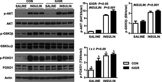 FIG. 4. The effect of growth restriction (IUGR) and hyperinsulinemia (insulin) on the activation of AKT, GSK3β, and FOXO1 in the fetal liver. Protein expression of p-AKT (S473), total AKT, p-GSK3β (S9), total GSK3β, p-FOXO1 (T24), total FOXO1, and actin was measured by Western blotting in whole-cell tissue lysates. Representative images are shown. Results were quantified and means ± SE are shown for saline (CON, n = 4; IUGR, n = 4) and insulin (CON, n = 6; IUGR, n = 6). Significant effects from two-way ANOVA are indicated.