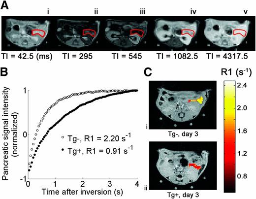 FIG. 2. A: A series of Look-Locker images showing an axial slice through the mouse abdomen, with the pancreas outlined in red. After inversion at time 0, longitudinal magnetization returns to equilibrium with relaxation rate constant R1. The specific time after inversion (TI, in ms) is indicated below each image. B: Example pancreatic signal intensity vs. time curves for a Tg− (white circles) mouse and Tg+ (black circles) mouse on day 3 after cyclophosphamide injection. Each data point on the curves represents the normalized pancreatic signal intensity measured at one TI. Pancreatic R1 was calculated by applying a monoexponential recovery model to each curve. C: Pixel-wise R1 maps of the pancreas from Tg− (i) and Tg+ (ii) mice on experimental day 3 overlain on high-resolution anatomic reference images. R1 is decreased in the Tg+ mouse at day 3 after cyclophosphamide injection.