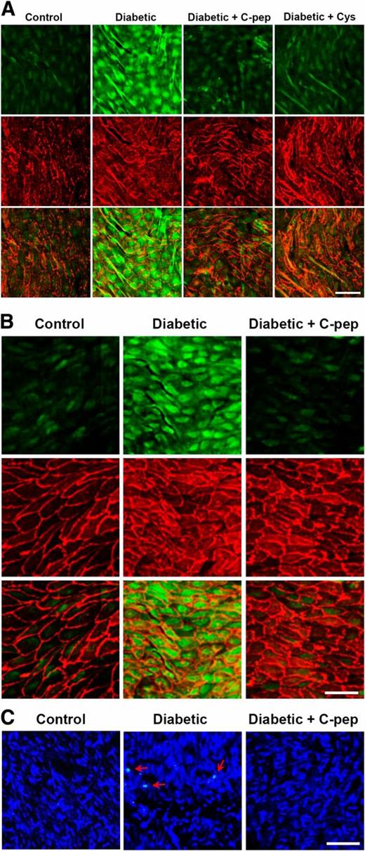 FIG. 6. C-peptide inhibits hyperglycemia-induced stimulation of transamidating activity and apoptosis in mice aortic segments. Transamidating activity (green) in aortic segments was double-stained with endothelial cell marker platelet endothelial cell adhesion molecule-I (red). A: Inhibition of hyperglycemia-induced stimulation of transamidating activity by ex vivo treatment of C-peptide (C-pep) or cystamine (Cys; n = 6 per group). B and C: C-peptide replacement therapy inhibits hyperglycemia-induced stimulation of transamidating activity and apoptosis in vivo (n = 8 for control and diabetes, n = 7 for diabetes + C-peptide). C: Apoptotic cells in aortic segments were stained by TUNEL (green, indicated by arrows) with nuclear counterstaining using Hoechst dye 33258 (blue). Bar: 50 μm. (A high-quality color representation of this figure is available in the online issue.)