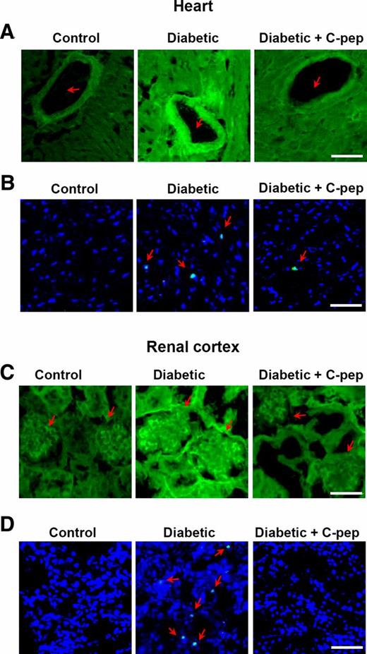 FIG. 7. C-peptide inhibits hyperglycemia-induced stimulation of transamidating activity and apoptosis in heart and renal cortex. In vivo treatment of C-peptide (C-pep) using osmotic pumps inhibits transamidating activity and apoptosis stimulated by hyperglycemia in heart (A and B) and renal cortex (n = 8 for control and diabetes, n = 7 for diabetes + C-peptide) (C and D). Transamidating activity was determined by confocal microscopy (green) in heart (A) and renal cortex tissues (C). Arrows indicate myocardium and associated blood vessels (A) and renal cortex, including glomeruli (C). Apoptotic cells were stained with TUNEL (green, indicated by arrows) in heart (B) and renal cortex tissues (D). Nuclei were visualized with Hoechst dye 33258 (blue). Bar: 50 μm. (A high-quality color representation of this figure is available in the online issue.)