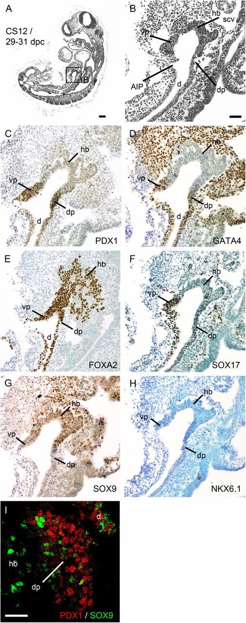 FIG. 2. Pancreatic endoderm in the distal foregut. Sagittal sections of a human embryo at CS 12/29–31 dpc stained with hematoxylin and eosin (A and B) or toluidine blue after immunohistochemistry (brown) for PDX1 (C), GATA4 (D), FOXA2 (E), SOX17 (F), SOX9 (G), and NKX6.1 (H). The boxed area in A is shown at higher magnification in B. I: Dual immunofluorescence at CS12 showing minimal PDX1 (red) and SOX9 (green) colocalization. d, duodenum; dp, dorsal pancreatic endoderm; hb, hepatic bud; scv, right subcardinal vein; vp, ventral pancreatic endoderm. Scale bars represent 200 µm (A), 100 µm (B–H), and 50 µm (I).