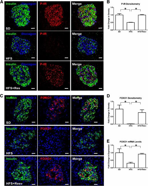 FIG. 3. Decreased P-IR and total FOXO1 levels in an HFS diet. A: Immunostaining for insulin (green), glucagon (blue), and tyrosine P-IR (red) in islets of monkeys after 24 months on SD (top panel), HFS diet (middle panel), or HFS+Resv diet (bottom panel). Scale bar = 20 µm. B: Quantitation of signal intensity for P-IR. Data are shown as the mean ± SEM. *P < 0.05. C: Immunostaining for insulin (green), TO-PRO-3 (blue), and total FOXO1 (red) in islets of monkeys after 24 months on SD (top panel), HFS (middle panel), or HFS+Resv (bottom panel) diets. Scale bar = 20 µm. D and E: Quantitation of signal intensity (D) and mRNA levels (E) for FOXO1. Data are shown as the mean ± SEM. *P < 0.05.
