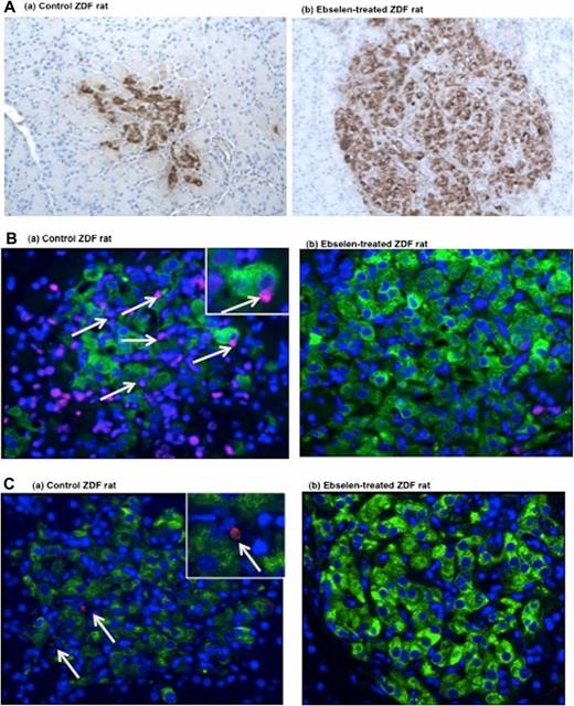 FIG. 3. Morphometric analysis of β-cells and apoptosis. (A) Islet morphology of control rats (a) and ebselen-treated rats (b) as shown by immunoperoxidase staining for insulin. (a) The control rats showed degranulation and irregularity in islet shape. (b) Ebselen-treated rat islets were double the size of islets from control rats, had robust granulation and a normal morphological pattern, and exhibited intense islet insulin staining (hematoxylin counterstained, n = 4) in β-cells. (B) The pancreatic tissue sections were stained for apoptosis using TUNEL method. TUNEL-positive nuclei (indicated by arrows) were (a) present in control rats and (b) rarely found in ebselen-treated rats (n = 4; magnification is 20×). The box represents the magnified area shown in insets. (C) Measurement of β-cell replication. Double immunostaining for Ki67 (red fluorescence indicated by arrows) and insulin (green fluorescence) in islets from rats treated with or without ebselen. (a) Control rats and (b) ebselen-treated rats islets did not stain for Ki67 (n = 4 each; magnification is 20×).