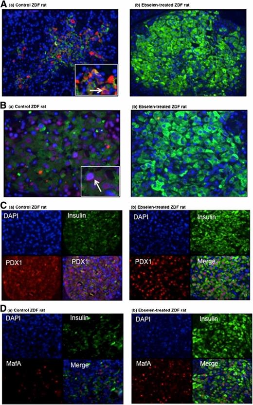 FIG. 4. Effect of ebselen on lipid peroxidation, DNA oxidation, Pdx-1, and MafA. See results for quantitative data and statistics. (A) Pancreatic sections were double labeled for insulin (green fluorescence) and 4-HNE (red fluorescence) using islets from control rats and ebselen-treated rats. (a) The control rats showed intense expression of 4-HNE in the cytoplasm of β-cells (red fluorescence indicated by arrow). (b) Inset represents a magnified area. Ebselen treatment prevented the expression of 4-HNE in β-cells, as shown in Fig. 2A (magnification is 20×). (B) Pancreatic sections were double immunostained for insulin (green fluorescence) and 8-OHdG (red fluorescence). (a) The control rats showed intense expression of 8-OHdG in the nuclei of β-cells (red fluorescence indicated by arrow). (b) β-Cells stained poorly for 8-OHdG in the ebselen-treated rats (n = 4). (C) Double-labeling immunofluorescent staining for insulin (green) and Pdx-1 (red) in islets from untreated or ebselen-treated rats. In control rats, the nuclear counts for Pdx-1 were fewer than were observed in the ebselen-treated rats. (D) Double-labeling immunofluorescence staining for insulin (green fluorescence) and MafA (red fluorescence) in islets from untreated or ebselen-treated rats. (a) Very few β-cells were present in islets from control animals, but most stained for nuclear MafA, (b) whereas islets from ebselen-treated rats showed many β-cells and greater intranuclear expression of MafA (magnification 20×). DAPI, 4',6-diamidino-2-phenylindole.