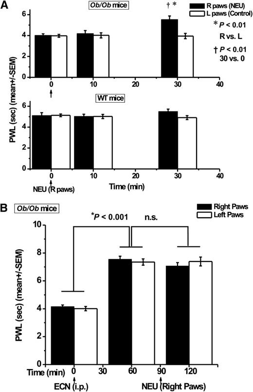 FIG. 8. NEU treatment in vivo reversed thermal hyperalgesia in diabetic ob/ob mice. A: The bar graphs with averaged data show that i.pl. injections of NEU completely reversed thermal hyperalgesia in diabetic ob/ob mice, while the same treatment was ineffective in WT mice. NEU was injected into right (R) paws, while uninjected left (L) paws served as controls. PWLs were determined in mice before (time point 0) and 10 and 30 min after injections of 10 μL NEU (arrows) into hind paws. Data are averages of seven experiments ±SEM. Symbols indicating significance of NEU treatments are as follows: *P < 0.01 for right vs. left paws at the same time points, and †P < 0.01 for data points at 30 min after NEU injections vs. 0 min. B: The bar graphs with averaged data show that injections of selective T-channel blocker ECN at 25 mg/kg i.p. completely reversed thermal hyperalgesia in diabetic ob/ob mice, as evidenced by elevated PWLs in both right and left paws (P < 0.001). Subsequent intraplantar injections of 1.5 units/mL NEU in the same animals did not significantly alter new baseline values of thermal PWLs (n.s., P > 0.05, n = 4). Arrows indicate times of injections of ECN and NEU.