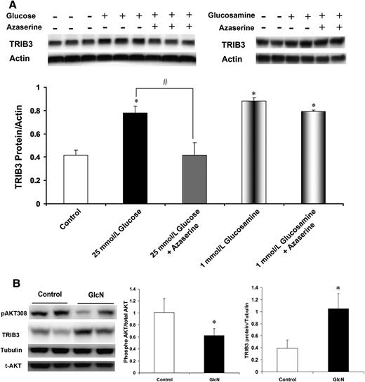 FIG. 4. Activation of HBP is required for induction of TRIB3 by glucose. A: In L6 myotubes, inhibition of HBP by azaserine (40 μmol/L) blocked the induction of TRIB3 expression by 25 mmol/L glucose, without affecting the induction of TRIB3 expression by 1 mmol/L glucosamine (GlcN). Culture medium with 25 mmol/L high glucose or 1 mmol/L glucosamine was added with 40 μmol/L azaserine for 24 h. B: Representative analysis of TRIB3 expression and AKT phosphorylation in skeletal muscle of mice injected with saline or glucosamine (70 mg/kg/day) for 7 days. t-AKT, total AKT. *P < 0.05 vs. control; #P < 0.05 vs. indicated group.