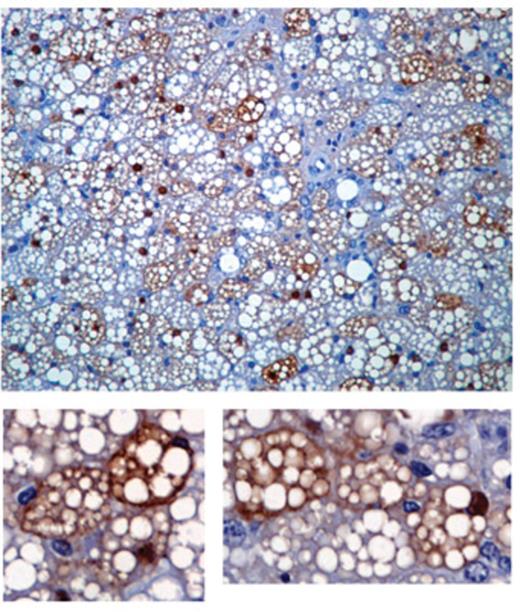 Immunostaining against green fluorescent protein (brown) in sections of intrascapular BAT.