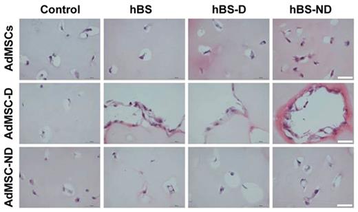 Hematoxylin and eosin staining shows adipose-derived mesenchymal stromal cells (AdMSCs)–mediated lysis of the fibrin gel.