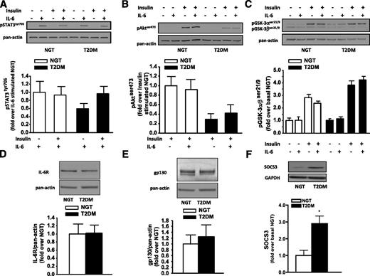 FIG. 5. A: Abundance of phosphorylated STAT3 in skeletal muscle cells after stimulation with IL-6 (n = 8 to 9). Note only IL-6–stimulated conditions were quantified because the basal STAT3tyr705 phosphorylation level was below detection limit. B: Insulin-stimulated phosphorylation of Aktser473 in skeletal muscle cells (n = 4). Note all conditions are insulin-stimulated because the basal Aktser473 phosphorylation level was below detection limit. C: Insulin-stimulated phosphorylation of GSK3α/βser21/9 in skeletal muscle cells (n = 3). D: IL-6R abundance (n = 4). E: gp130 abundance (n = 4). F: Abundance of SOCS3 in skeletal muscle cells (n = 6 to 7). Pan-actin and glyceraldehyde-3-phosphate dehydrogenase (GAPDH) are shown as markers of protein loading. P < 0.05. NGT, normal glucose tolerant; p, phosphorylation; T2DM, type 2 diabetes.