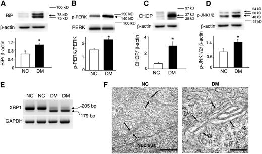FIG. 1. Maternal diabetes increases the expression of ER stress markers and induces abnormal ER morphology in neuroepithelial cells. Levels of BiP (A), p-PERK (B), CHOP (C), and p-JNK1/2 (D) were determined in E8.75 WT embryos from nondiabetic control (NC) and diabetes mellitus (DM) WT mice. E: XBP1 mRNA splicing was detected by reverse transcription and subsequent PCR. F: ER with swollen/enlarged lumens was observed in neuroepithelial cells of embryos from the DM group but not in those of embryos from the NC group. Black arrows point to the ER. Scale bars, 50 nm. In A–D, arrows point to the actual sizes of the targeted proteins, and adjacent protein markers are indicated. Experiments were repeated three times using samples from different dams in each group. *Significant difference (P < 0.05) between the two groups.