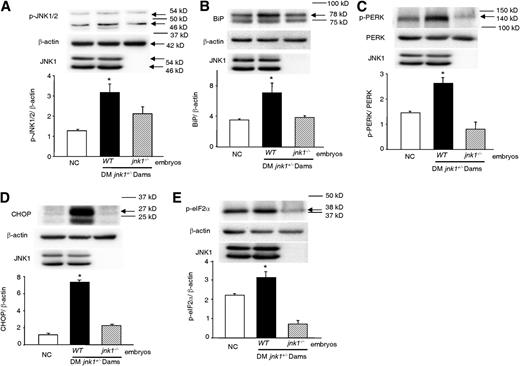 FIG. 2. Deletion of the jnk1 gene blocks maternal diabetes–induced ER stress. Levels of p-JNK1/2 (A), BiP (B), p-PERK (C), CHOP (D), and p-eIF2α (E) in WT embryos from the nondiabetic control (NC) group and WT embryos and jnk1−/− embryos from the same group of diabetic jnk1+/− dams (DM-jnk1+/−) mated with jnk1+/− males. Experiments were repeated three times using samples from different dams in each group. Arrows point to the actual sizes of the targeted proteins, and adjacent protein markers are indicated. *Significant difference (P < 0.05) compared with the other two groups.